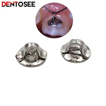10buc/pachet Dentar Ortodontic Lingual Butonul de Jos de Legat Metal Limba Cataramă Laterală Stomatologie Materiale